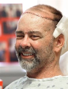 In this photo taken on Wednesday, June 3, 2015, James Boysen is interviewed in his hospital bed at Houston Methodist Hospital in Houston. Texas doctors say he received the world's first skull and scalp transplant from a human donor to help heal a large head wound from cancer treatment. (AP Photo/Pat Sullivan)