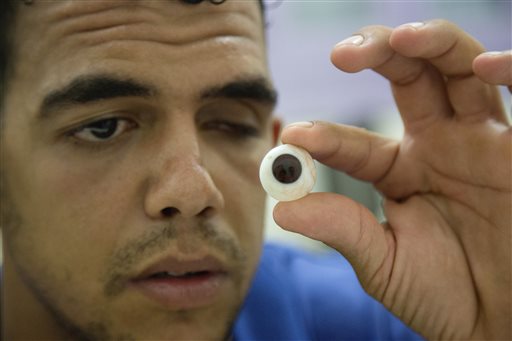 Prosthetic eye maker brings relief to wounded&nbsp;Gazans
