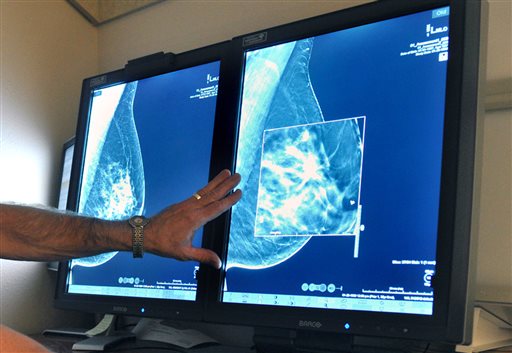 Cancer group’s mammogram advice: Start later and get&nbsp;fewer