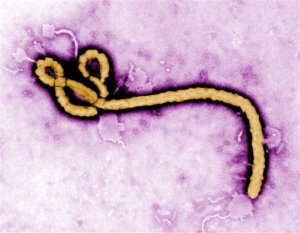 FILE - In this undated colorized transmission electron micrograph file image made available by the CDC shows an Ebola virus virion. For the first time, Ebola has been discovered inside the eyes of a patient months after the virus was gone from his blood, according to a report published Wednesday Oct. 14, 2015, in the New England Journal of Medicine. Doctors have found Ebola can survive in some male survivors for up to nine months after they first get sick but arent sure if that means they might still be infectious, according to the new research published Wednesday. (Frederick Murphy/CDC via AP, File)