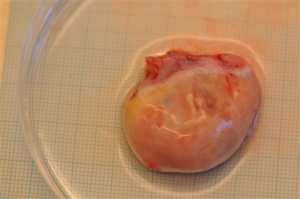 In this undated photo provided by the University Hospital of Copenhagen, an ovary recently removed from a woman about to undergo cancer treatment is seen in a petri dish.The biggest study ever of women who had ovarian tissue removed, frozen and transplanted suggests the experimental technique is safe and can help about one third of them to have babies.  The procedure is intended for women with cancer who wish to preserve their fertility as cancer treatments can harm the ovaries. Scientists typically remove one ovary, cut it into strips and then graft some of that tissue onto the remaining ovary years later after the woman has recovered from cancer. Researchers tracked 41 women in Denmark who underwent the procedure from 2003 to 2014. Among the 32 women in the study who wanted children, 10 later got pregnant and gave birth. The paper was published online Wednesday, Oct. 7, 2015 in the journal, Human Reproduction.  (Claus Yding Andersen/University Hospital of Copenhagen via AP)