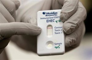 A microbiologist points out a positive confirmation of E. coli on a testing device from a patient specimen in a lab at the Washington State Dept. of Health, Tuesday, Nov. 3, 2015, in Shoreline, Wash. Chipotle's industry-leading commitment to tracking its ingredients from farm to table is being put to the test by an E. coli outbreak that has sickened at least 37 people as of Tuesday, nearly all of whom ate recently at one of the chain's restaurants in Washington state or Oregon. Scientists also said that they identified the specific microorganism responsible, which they believe was carried on fresh produce such as lettuce or tomatoes. (AP Photo/Elaine Thompson)