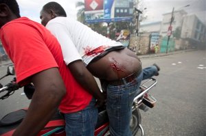 A protester is taken to hospital after he was wounded by birdshot during a street protest after it was announced that the runoff Jan. 24, presidential election had been postponed, in Port-au-Prince, Haiti, Friday, Jan. 22, 2016. The Provisional Electoral Council in Haiti has postponed the election amid escalating protests by the opposition, which claims the first round was marred by fraud in favor of a government-backed candidate. (AP Photo/Dieu Nalio Chery)