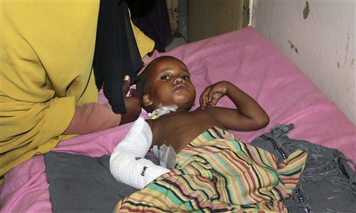 Somalia attack turns symbol of resurgence into one of&nbsp;grief