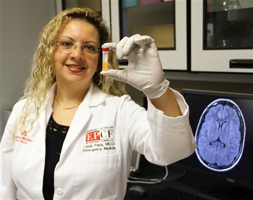 This undated photo provided by Orlando Health shows Linda Papa, MD, MSC, an emergency medicine physician at Orlando Health in Orlando, Fla.  New research bolsters evidence that a simple blood test may someday be used to detect concussions and other brain trauma. The study involved patients treated at the trauma center and the results are preliminary, a concussion blood test based on the proteins studied or on biomarkers other researchers are investigating is likely years away from routine use. (Orlando Health via AP)