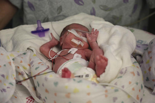 Better preemie pain relief sought amid new call for&nbsp;action