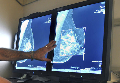 Study questions value of mammograms, breast cancer&nbsp;screening